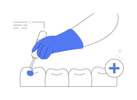 Fissure sealants abstract concept vector illustration. Stock Illustration