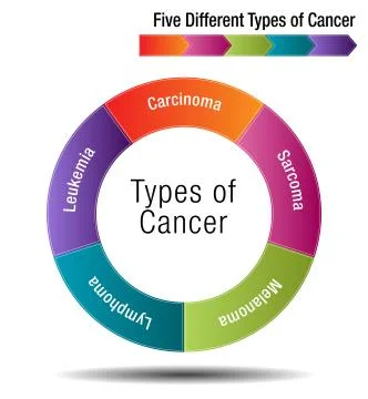 Five Different Types of Cancer Illustrazione stock