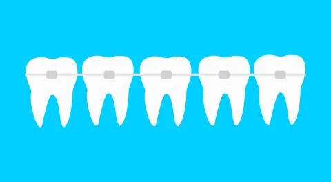 Five teeth with dental braces vector illustration. Orthodontic treatment Stock Illustration
