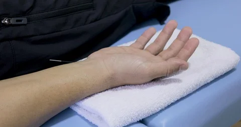 Fix camera capturing man receiving acupuncture session on his wrist. To Stock Footage 120973006