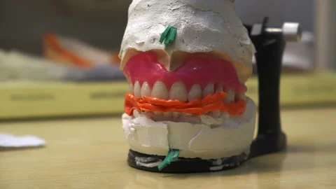 Fixed bite of wax prostheses in the articulator Stock Footage 212143233