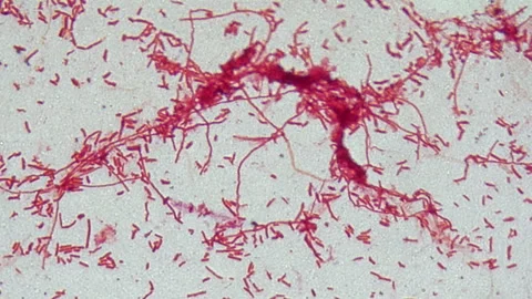 A fixed sample of bacterial culture. Stock Footage 241105926