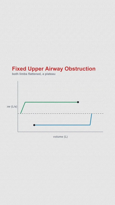 Fixed Upper Airway Obstruction Labeled Spirometry Flow Vertical 9x16 Light Vídeo Stock 339508090