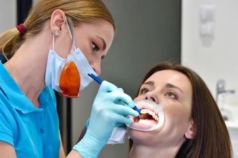 Fixing Braces On The Teeth Foto stock