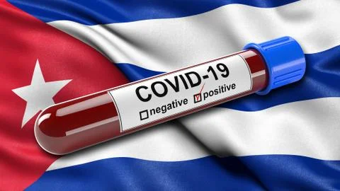 Flag of Cuba waving in the wind with a positive Covid-19 blood test tube. 3D イラスト素材