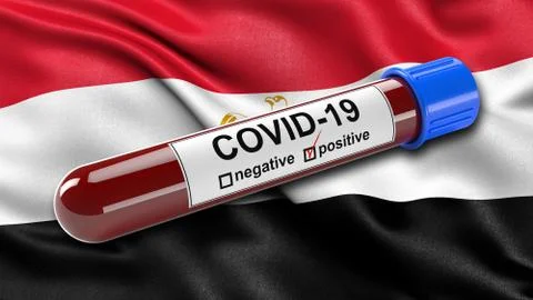 Flag of Egypt waving in the wind with a positive Covid-19 blood test tube. 3D イラスト素材