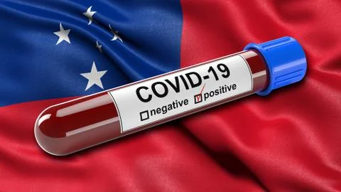 Flag of Samoa waving in the wind with a positive Covid-19 blood test tube. 3D イラスト素材