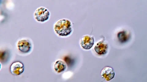 Flagellated Haptophyte Algae Drifting in Microscopic Water Sample, 1000, Stock-Footage 317016172
