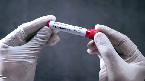 The flask with the test of coronavirus Stock Footage 143719783