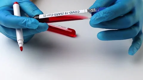 Flasks with blood tests for monkey pox virus positive and negative, mpox Stock Footage 233356694
