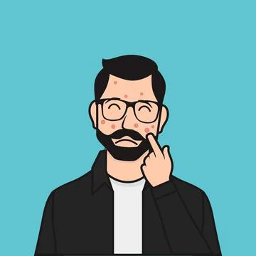 Flat Bearded Man Pointing Hand at His Pimple Vector Illustration Stock Illustration