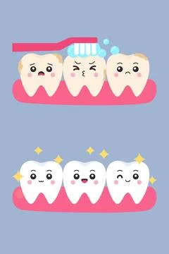 Flat cartoon stained yellow teeth being brushed and clean sparkling white t.. Stock Illustration