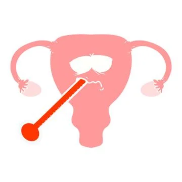 Flat color style cartoon poorly uterus Stock Illustration