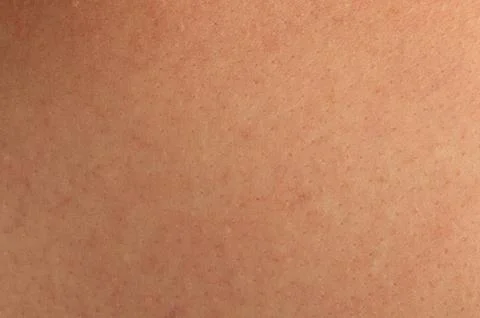 Flat patch of human skin Stock Photos