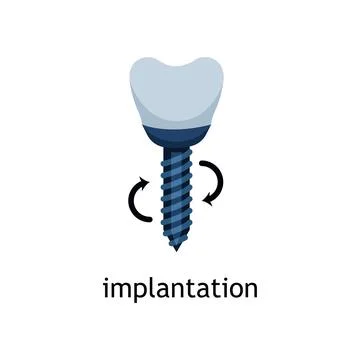 Flat vector icon of a tooth implant. Dental implantation Stock Illustration