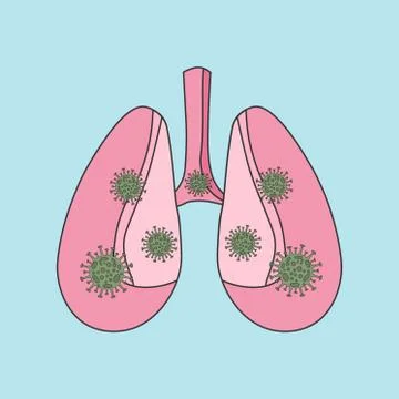 Flat vector illustration of lungs and bacteria covid-19 coronavirus. Coronavirus Stock Illustration