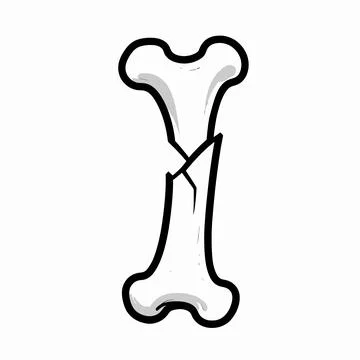 Flat vector illustration of a single fractured human femur bone, minimalist.. Illustrazione stock