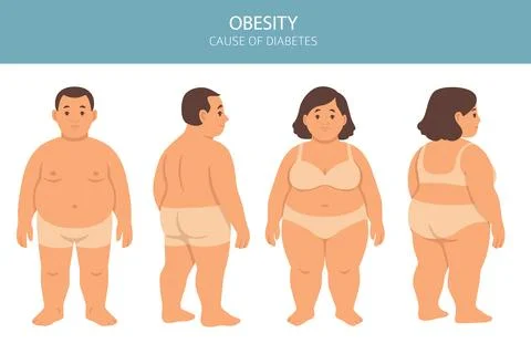 Flat vector illustration of weight loss concept. Before and after body tran.. Stock Illustration