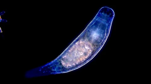 Flat Worms larvae Observed Through dark field Microscopy,  400x 動画素材 317925846