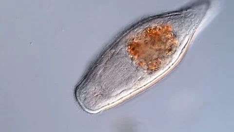 Flatworm (microscopy view 400x) 库存影片 310640412