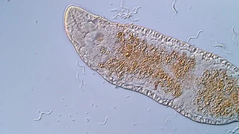 Flatworm Morphology in High Magnification View Vídeos de archivo 317211175