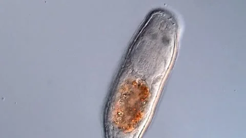 Flatworm in pond water under microscope Vidéo 310640124