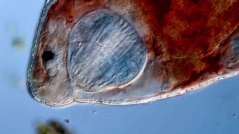 Flatworm Turbellarian under microscope Vídeos de archivo 310655054