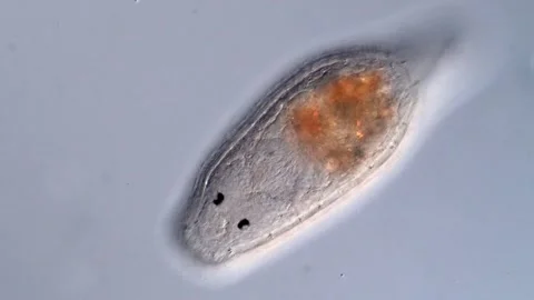 Flatworm Turbellarian under microscope view 库存影片 310640435