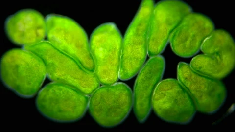 Flatworm Typhloplana sp. under a microscope, the Typhloplanidae family Stock Footage 131814516