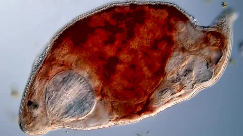 Flatworm under microscope 400x magnification Vídeos de archivo 310657007