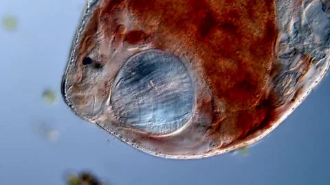 Flatworm under microscope 400x magnification 库存影片 310657026