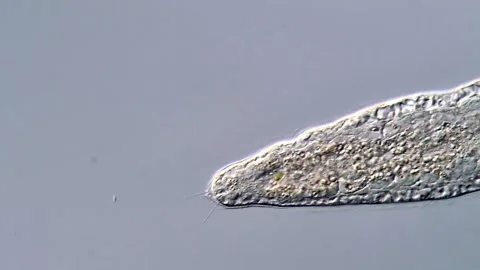 Flatworm under microscope, 400x magnification 스톡 동영상 317210631
