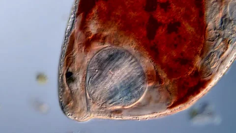 Flatworm under the microscope Vídeos de archivo 310657503