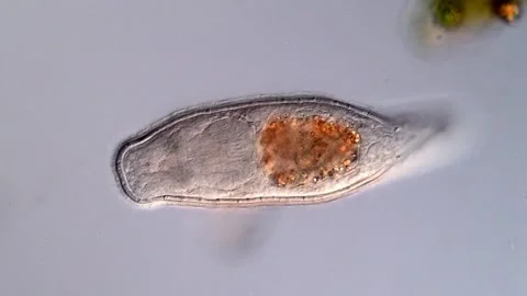 Flatworm under microscope view 400x magnification 库存影片 310640056