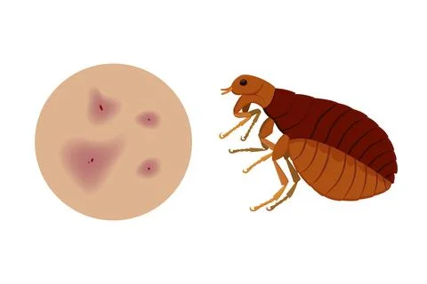 Flea causing skin irritation and itching sensation Stock Illustration
