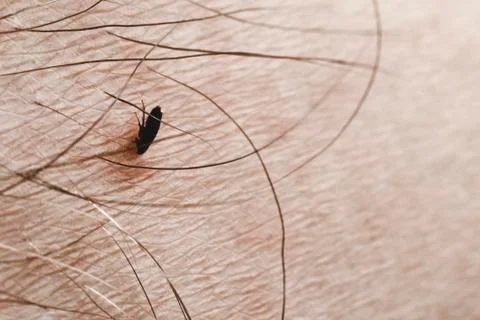 Fleas bite human skin. she is alive. A tiny parasite sucking the blood of peo Stock Photos
