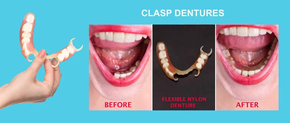 Flexible nylon denture Stock Photos