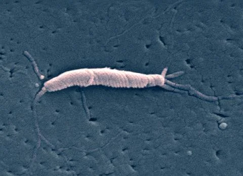  Flexispira rappini This scanning electron micrograph depicts a \Flexispir... Stock Photos
