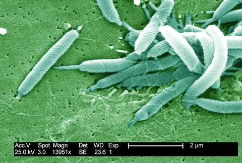  Flexispira rappini This scanning electron micrograph depicts a grouping o... Stock Photos