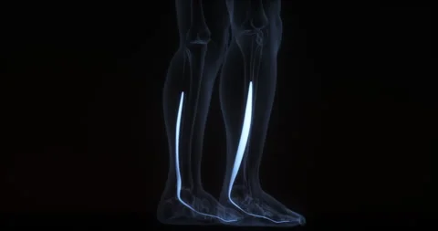 Flexor hallucis longus muscle in human body. X Ray. Loop Stock Footage 340065503