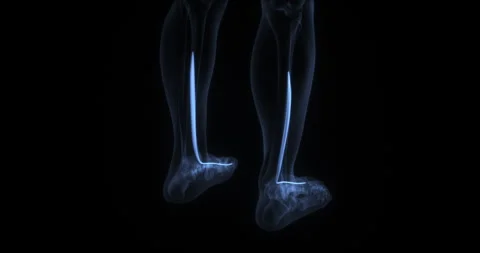 Flexor hallucis longus muscle in human body. X Ray. Loop Stock Footage 341425813