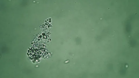 A flock of small infusoria feeds in a microscope on a green background Stock Footage 121984080