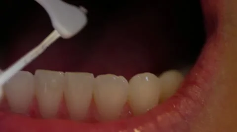 Flossing-Extreme Close Up Stock Footage 22140664