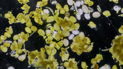 Flower Pollen Under Microscope Lily Flower Sample Stock Footage 44298388