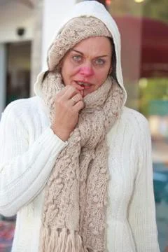 Flu epidemic Stock Photos