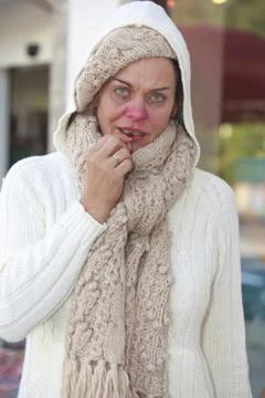 Flu epidemic Stock Photos