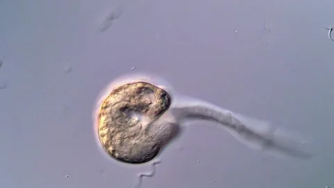 Fluke Cercariae Larvae under High Magnification 库存影片 317223149