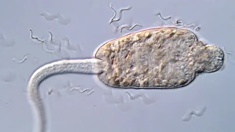 Fluke Larvae in Motion under Light Microscope 库存影片 317227038