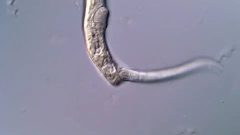 Fluke Larvae Movement Seen under Microscope Vídeos de archivo 317223634