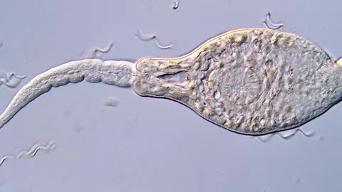 Fluke Parasite Larvae under Microscope with Detail 库存影片 317226645